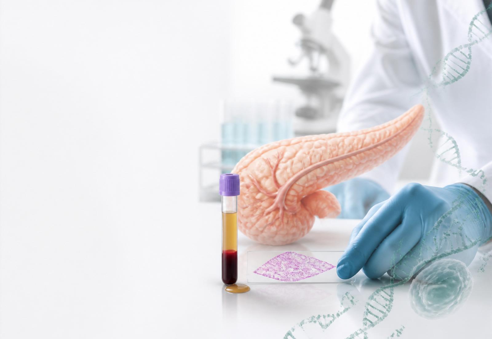 Human pancreas anatomy, plasma collection tube, and pathology slide in a clinical laboratory