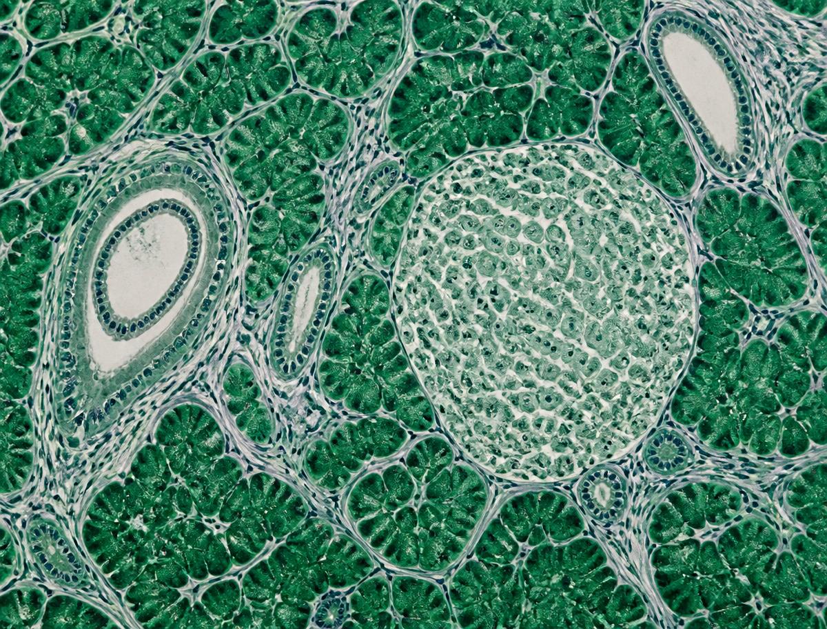 Histopathology of healthy human pancreatic tissue showing organized acinar lobules, intact ducts and an islet of Langerhans