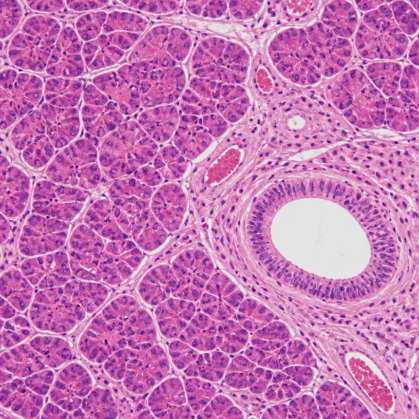 Histology of healthy pancreatic tissue with organized acinar lobules and a normal duct