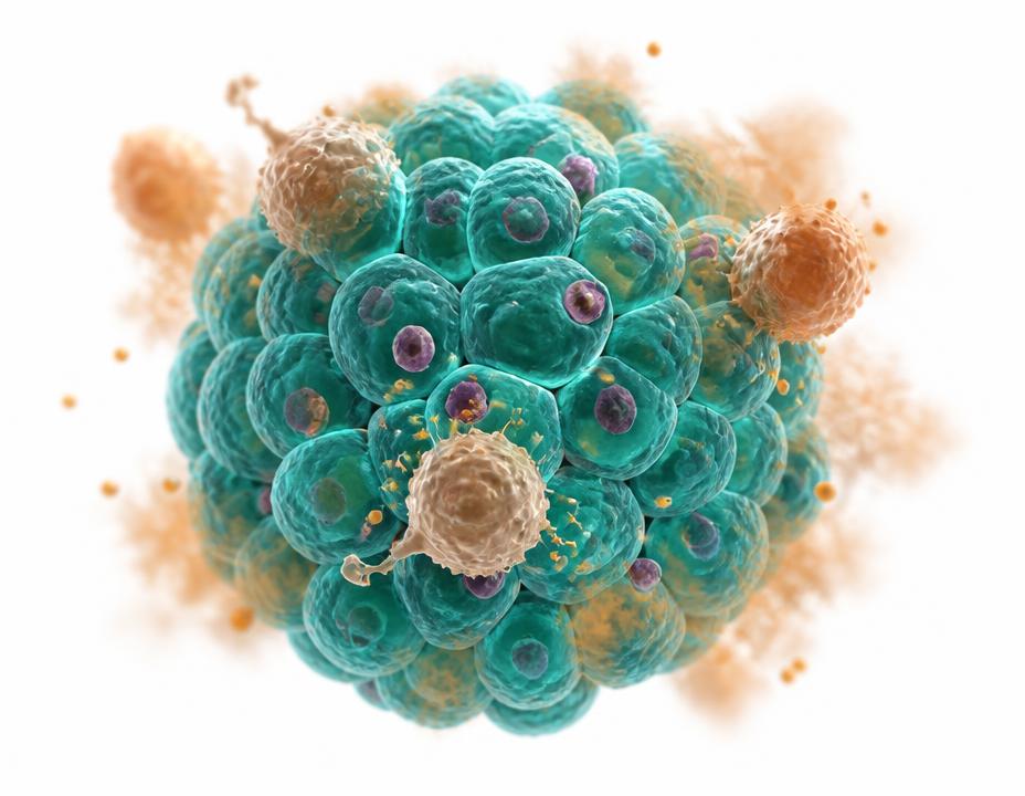 Illustration of a pancreatic islet infiltrated by macrophages and inflammatory particles