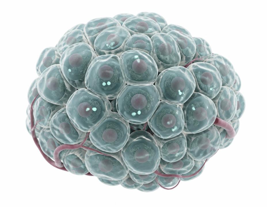 Illustration of a depleted pancreatic islet with sparse insulin granules